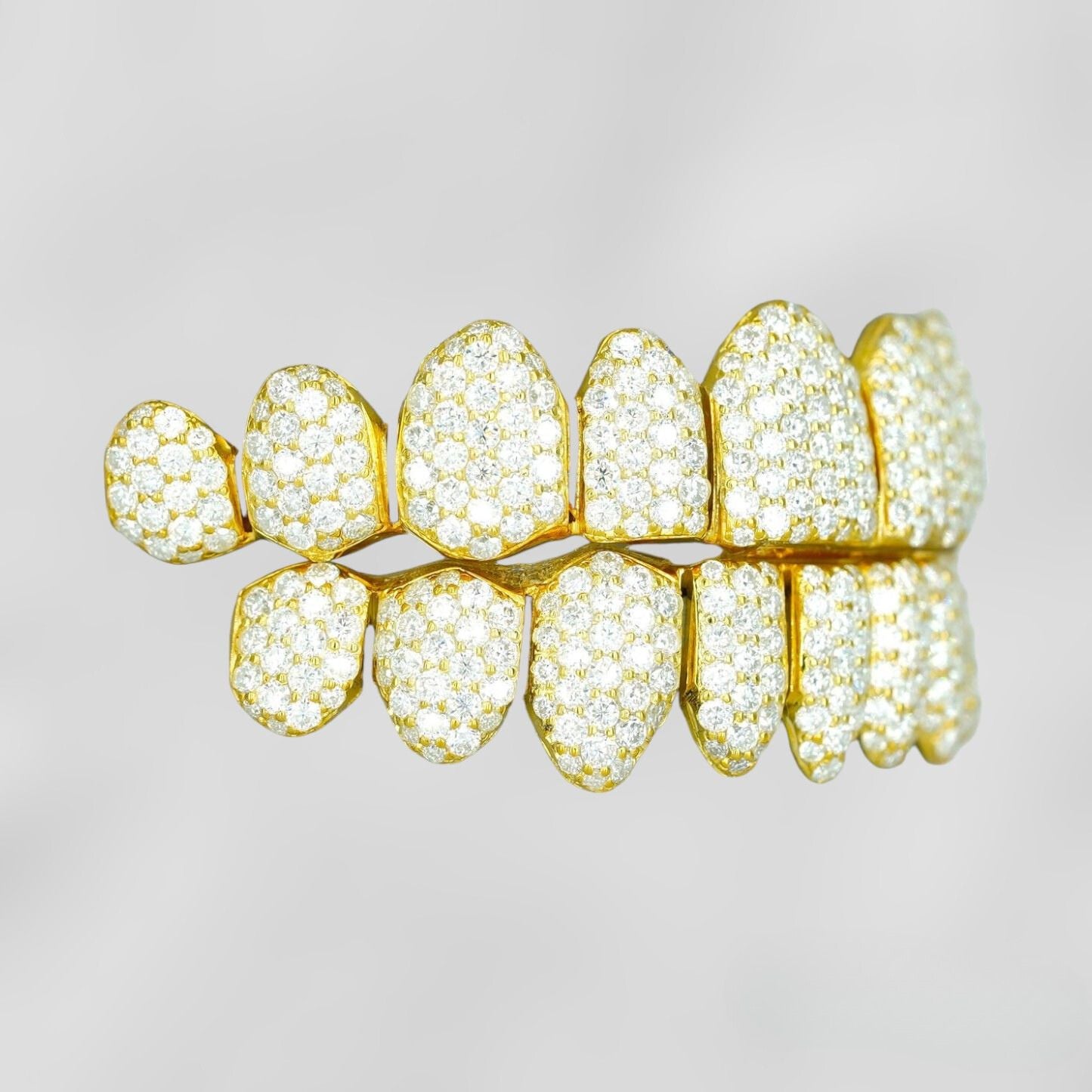 What are Moissanite Grillz?