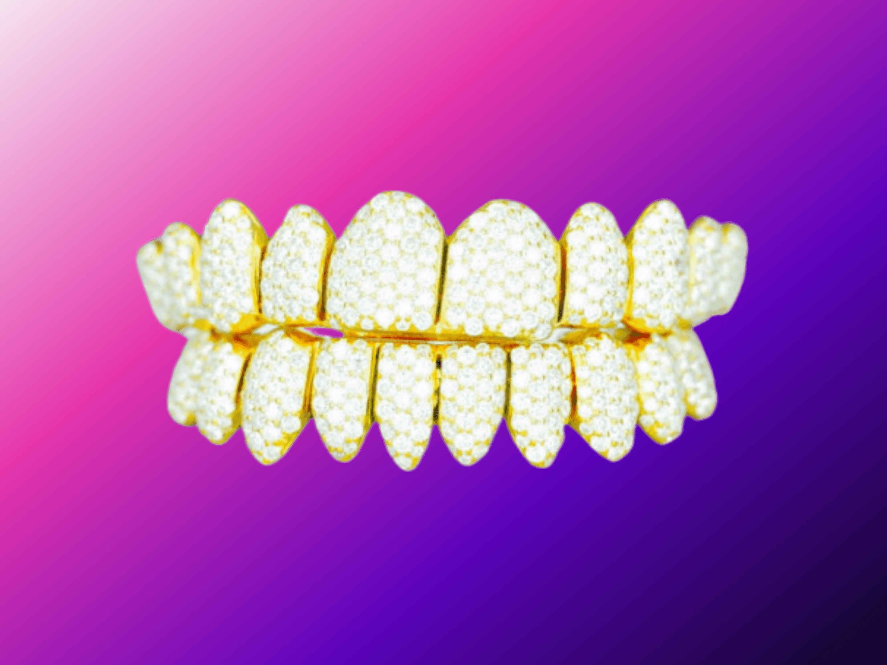 10 on 10 VVS Moissanite Diamond Grillz