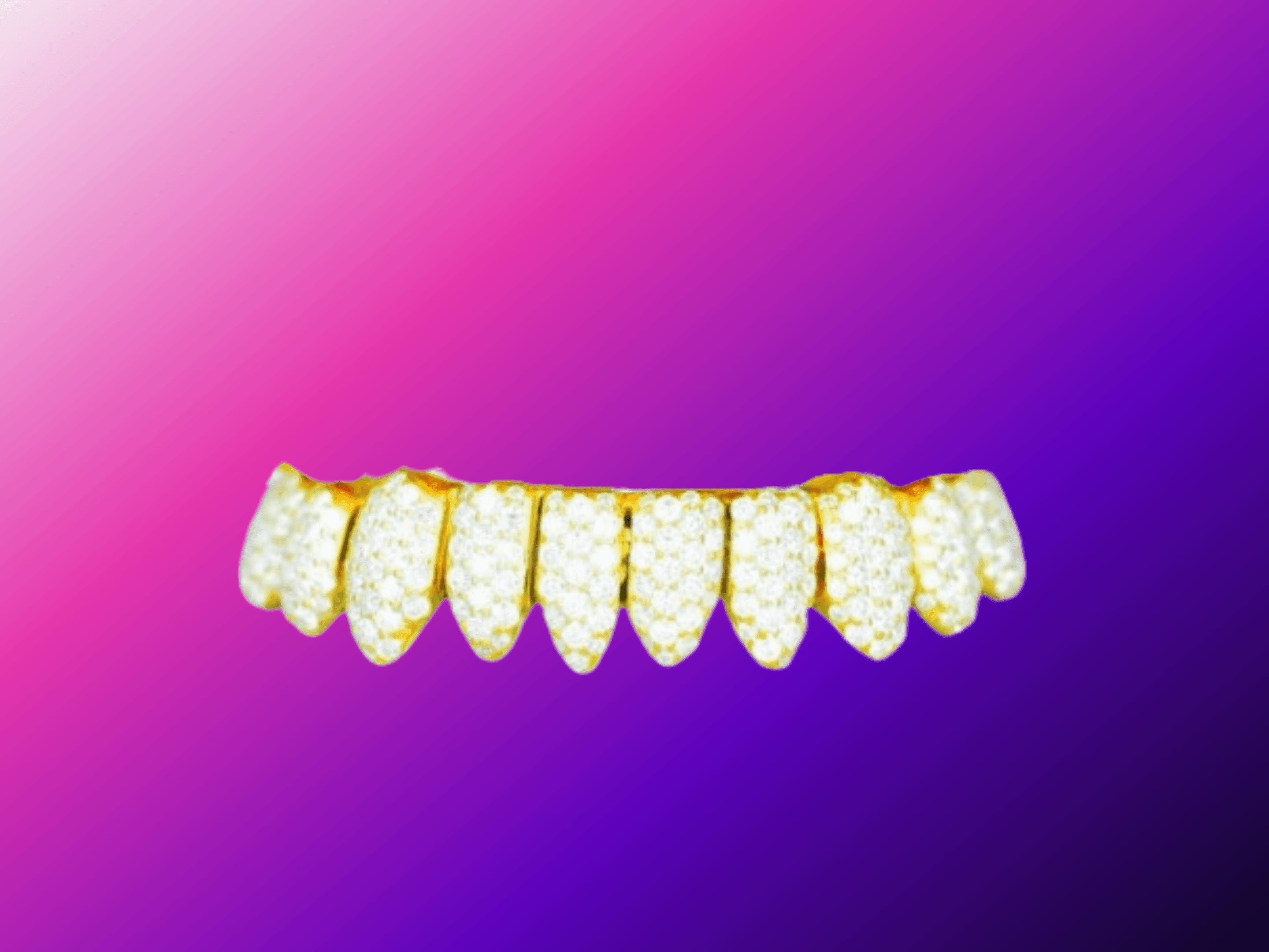 10 on 10 VVS Moissanite Diamond Grillz