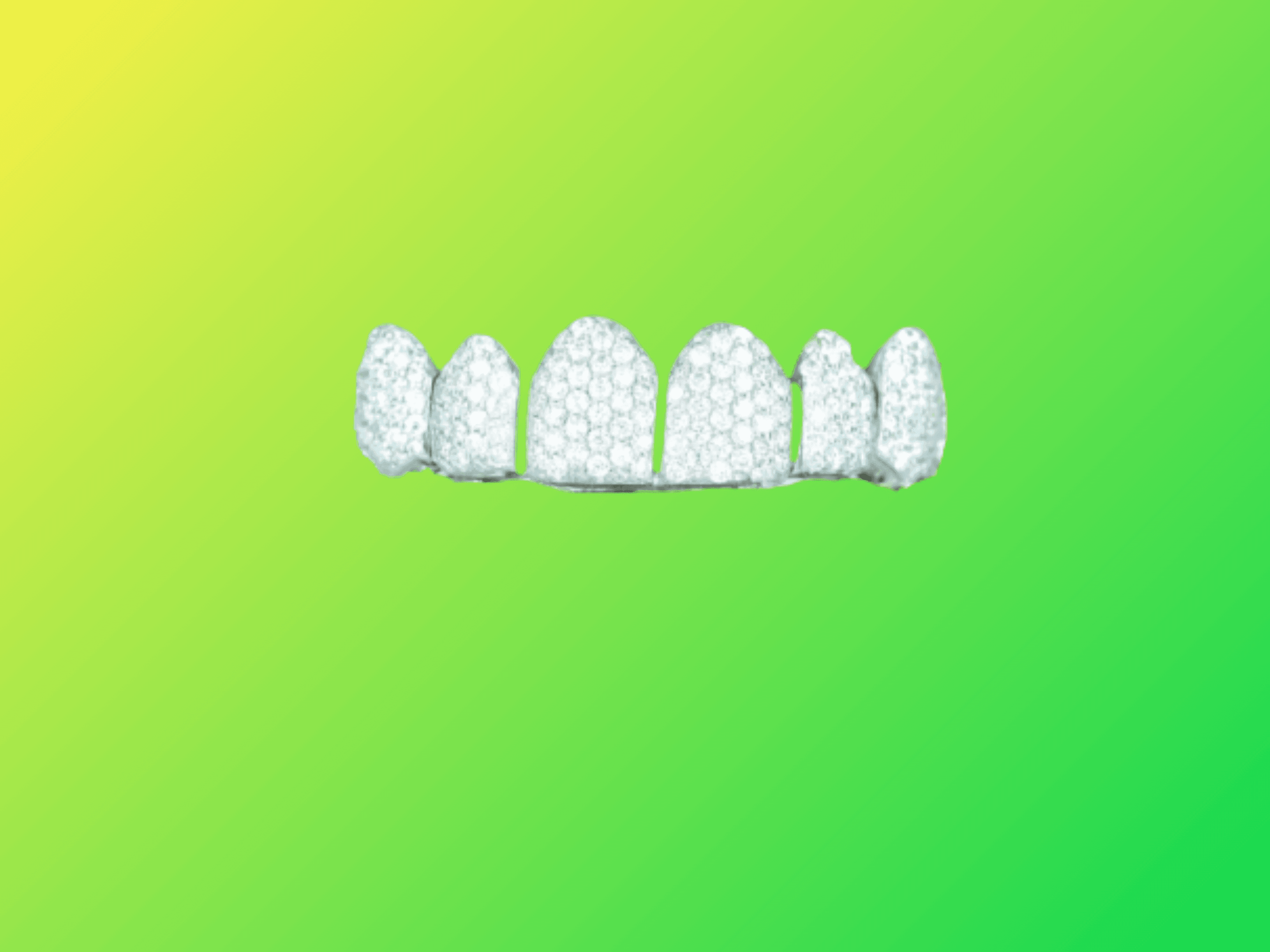 6 on 6 VVS Moissanite Diamond Grillz